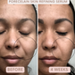 Porecelain™ Skin Refining Serum