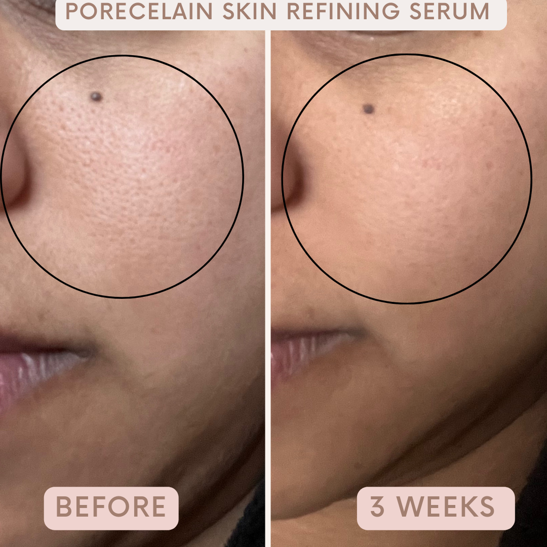 Porecelain™ Skin Refining Serum