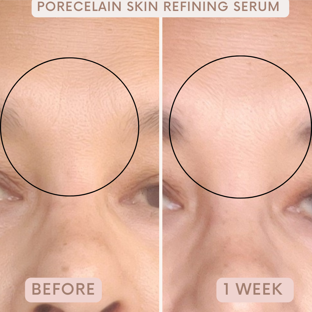 Porecelain™ Skin Refining Serum
